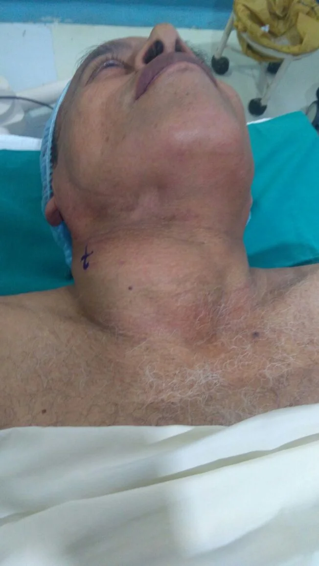 Cancer Patients