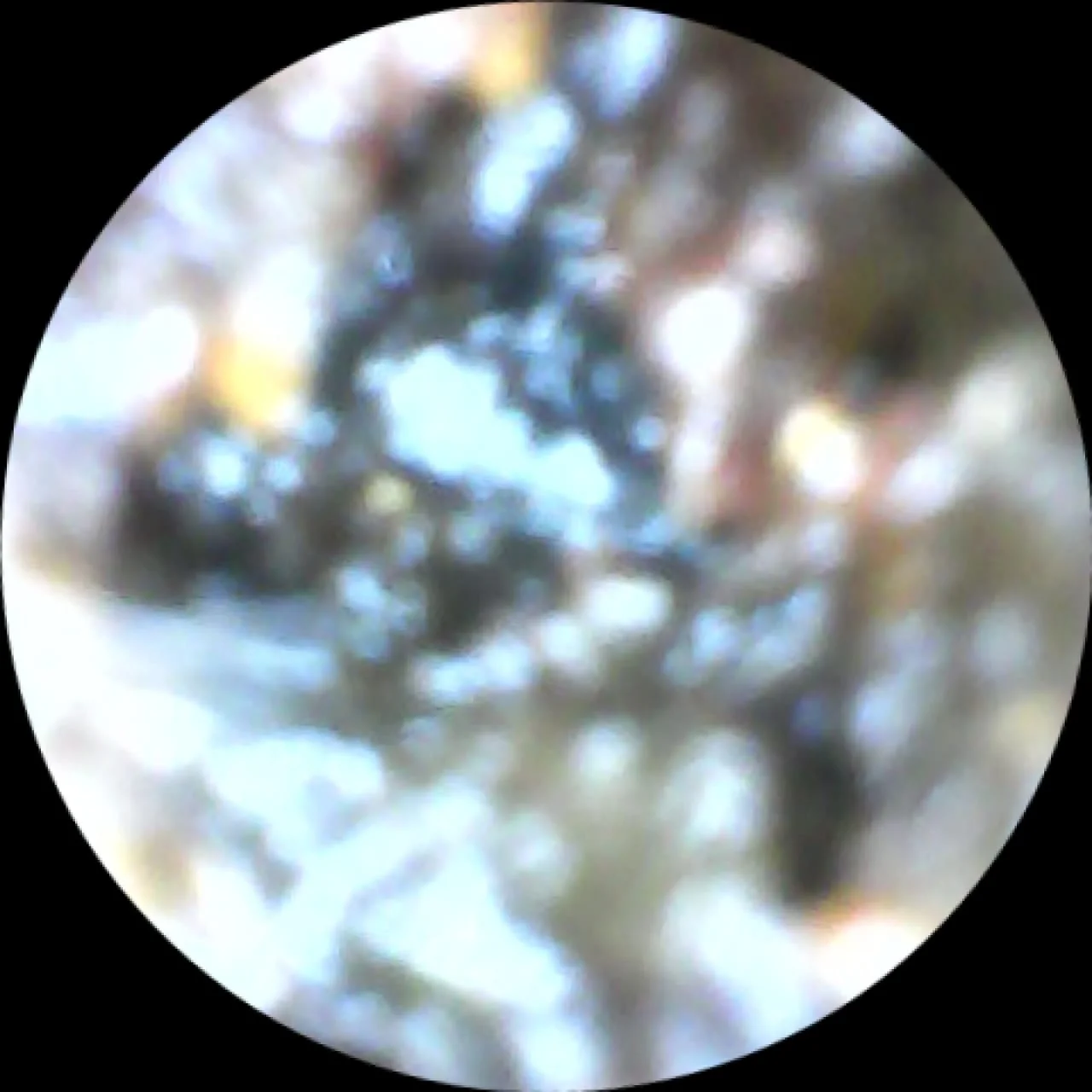 Ear Endoscopy
