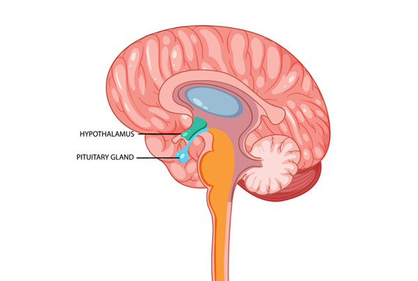 Pituitary Tumors